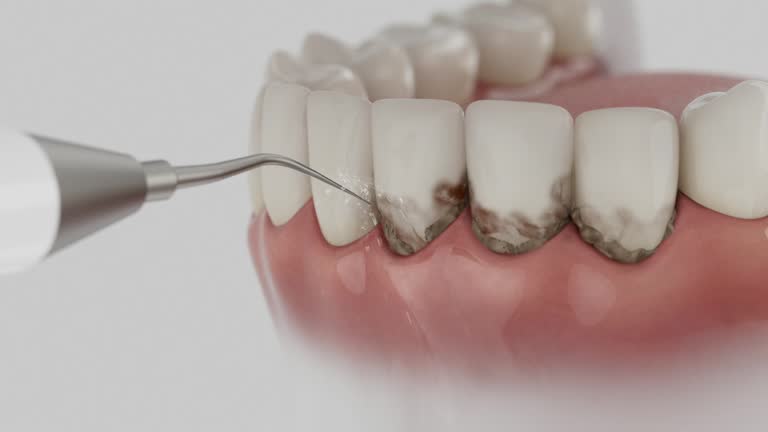 Reliable Dental Implants contractor in Morton, PA by Smile Center Dentistry